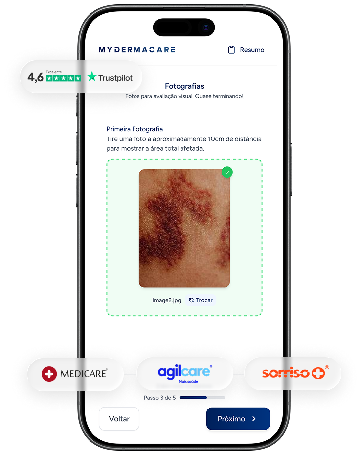 Aplicação MyDermaCare — relatório médico e receita