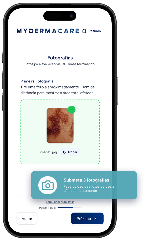 Upload de imagens