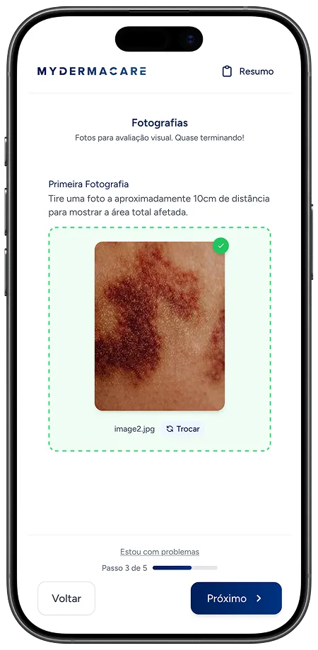 Submissão de um novo pedido na aplicação MyDermaCare
