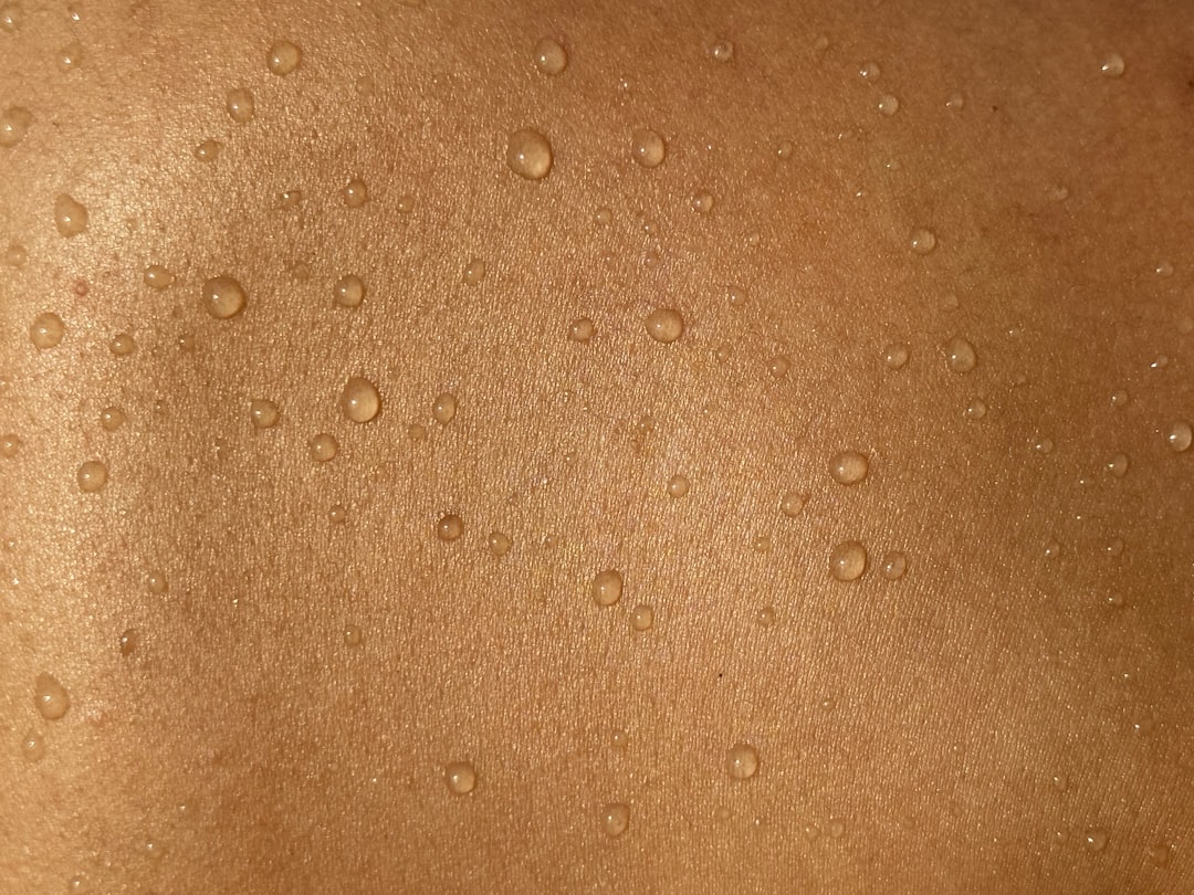 nevo atípico displásico avaliação dermatológica