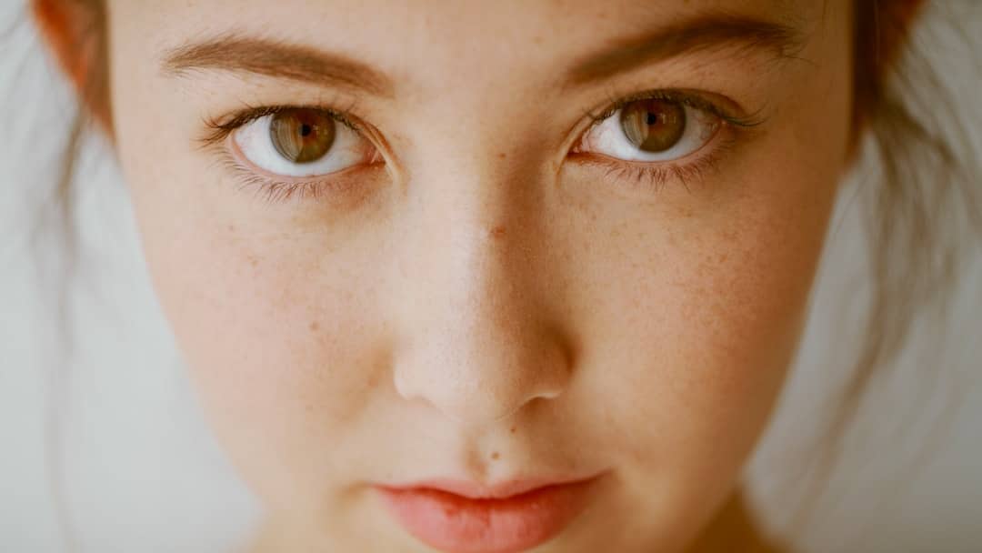 acne hormonal queixo mandíbula
